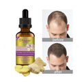 Aceite anticaida Haircare jengibre serum